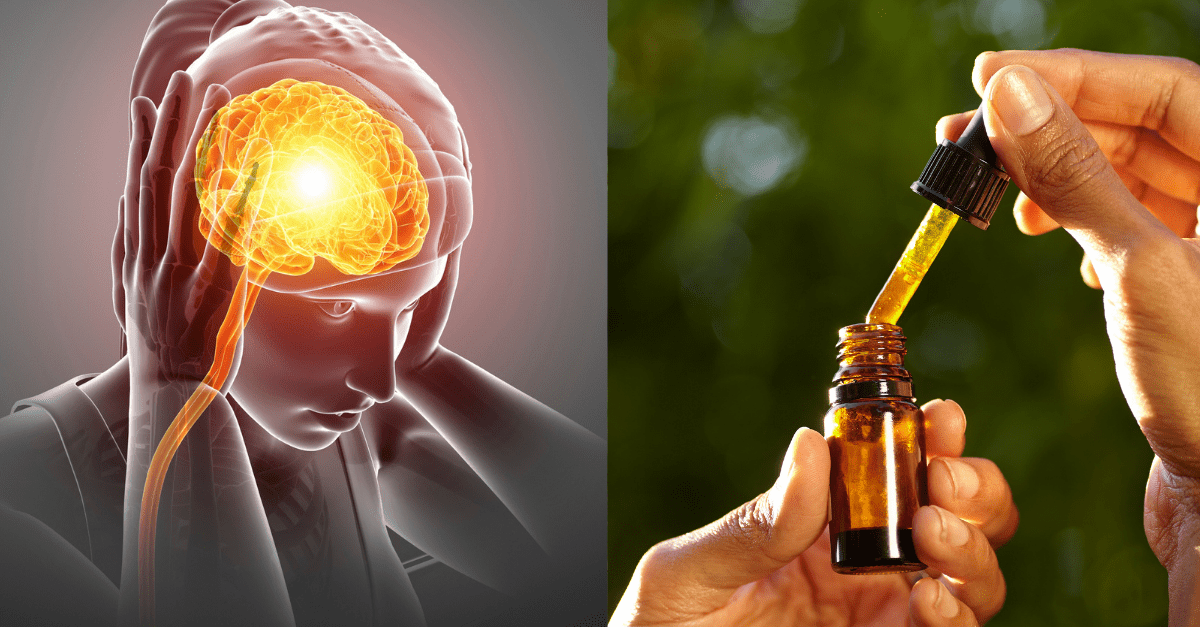 Does CBD help with migraine 1