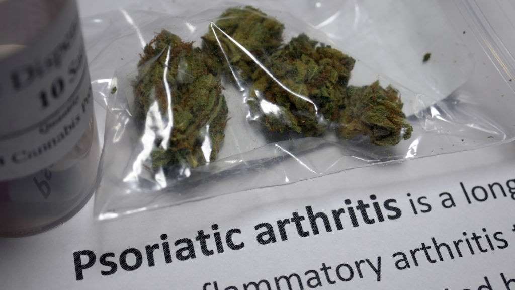 CBD Oil for Psoriatic Arthritis