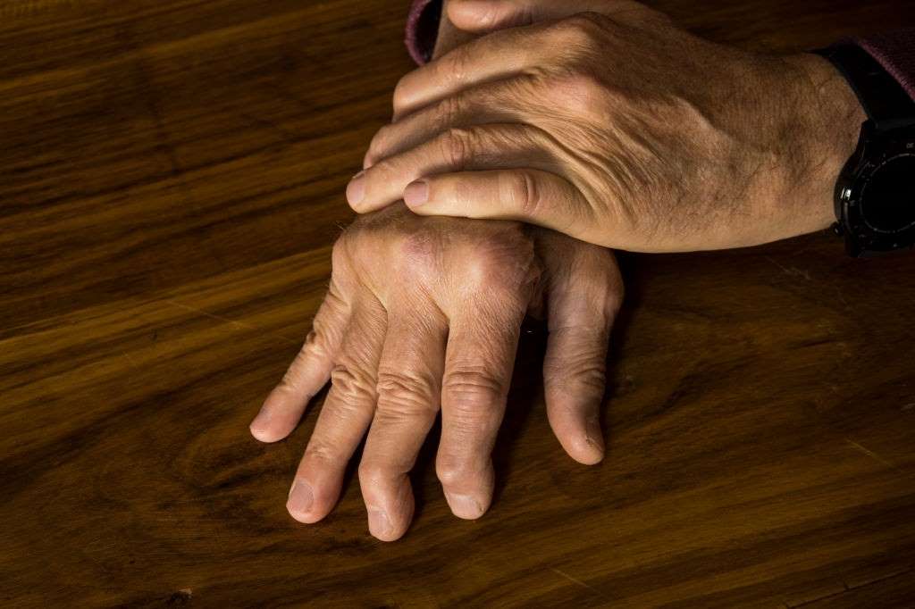 psoriaitic-arthritis