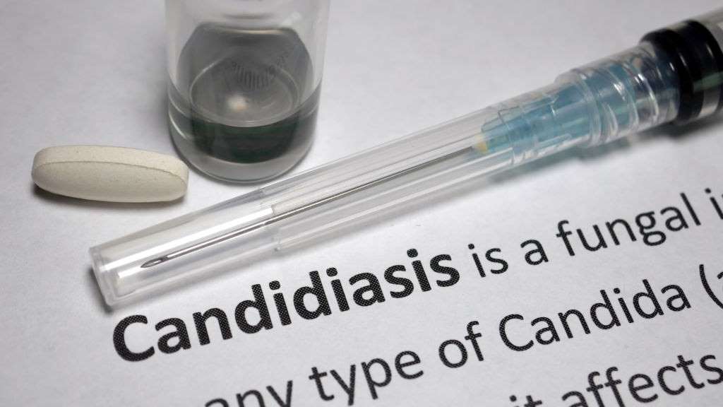 CBD oil for candidiasis